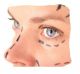 Cosmetic Surgery